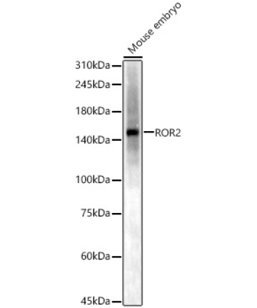 ROR2 Rabbit Polyclonal Antibody