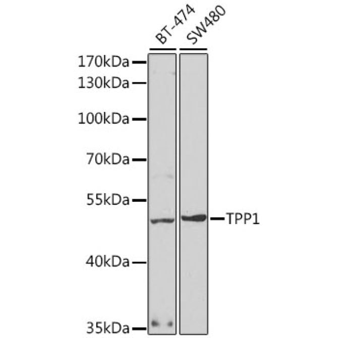TPP1 Rabbit Polyclonal Antibody