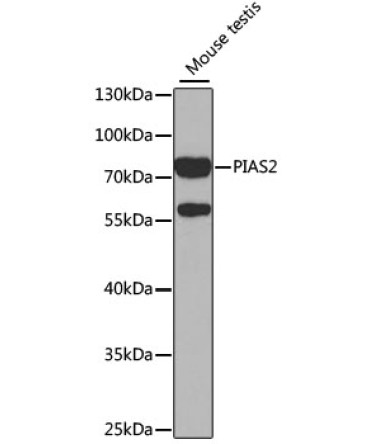 PIAS2 Rabbit Polyclonal Antibody