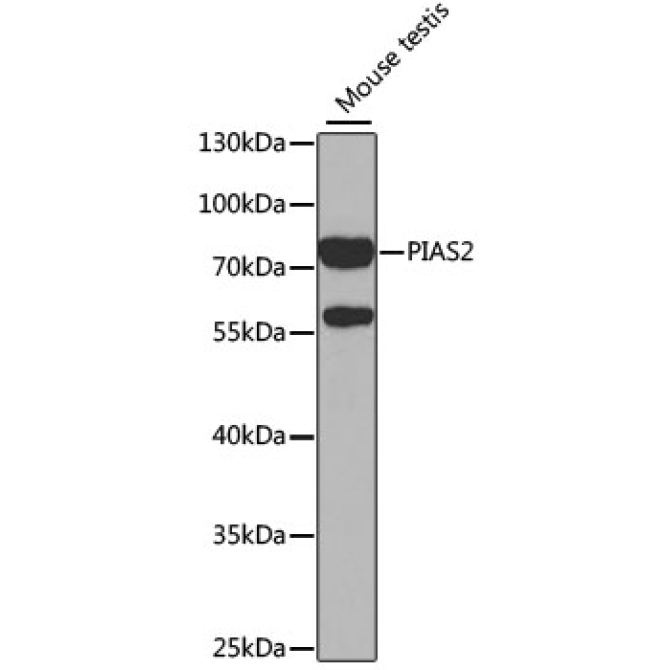 PIAS2 Rabbit Polyclonal Antibody