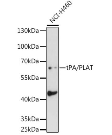 tPA/PLAT Rabbit Polyclonal Antibody