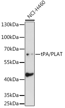 tPA/PLAT Rabbit Polyclonal Antibody