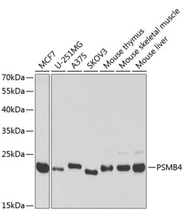 PSMB4 Rabbit Polyclonal Antibody