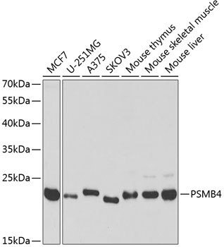 PSMB4 Rabbit Polyclonal Antibody