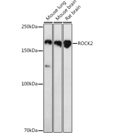 ROCK2 Rabbit Polyclonal Antibody