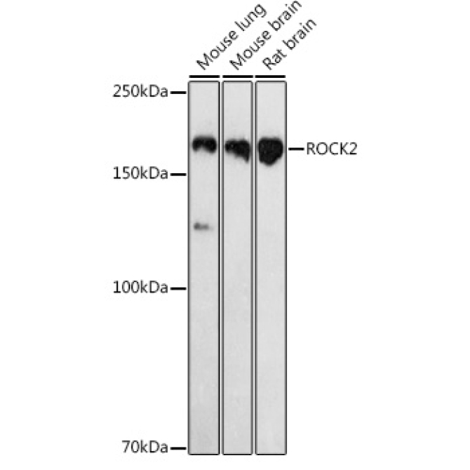 ROCK2 Rabbit Polyclonal Antibody