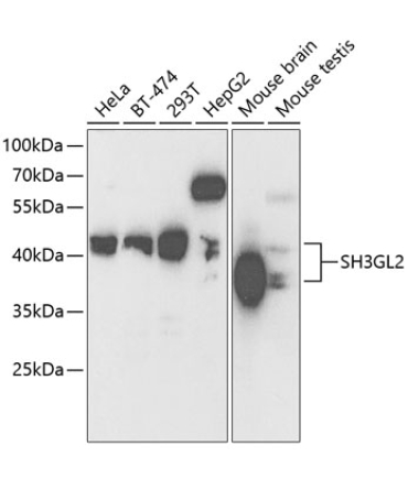 SH3GL2 Rabbit Polyclonal Antibody