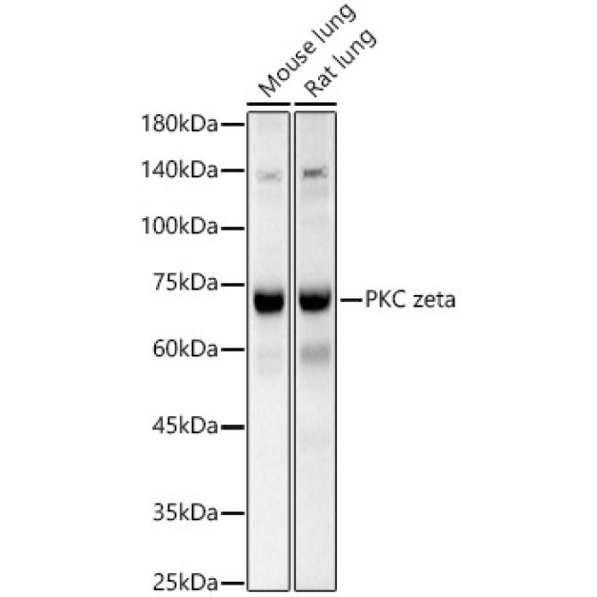 PKC zeta Rabbit Polyclonal Antibody