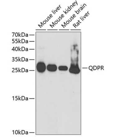 QDPR Rabbit Polyclonal Antibody