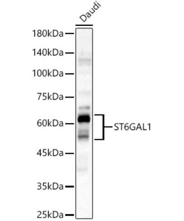 ST6GAL1 Rabbit Polyclonal Antibody