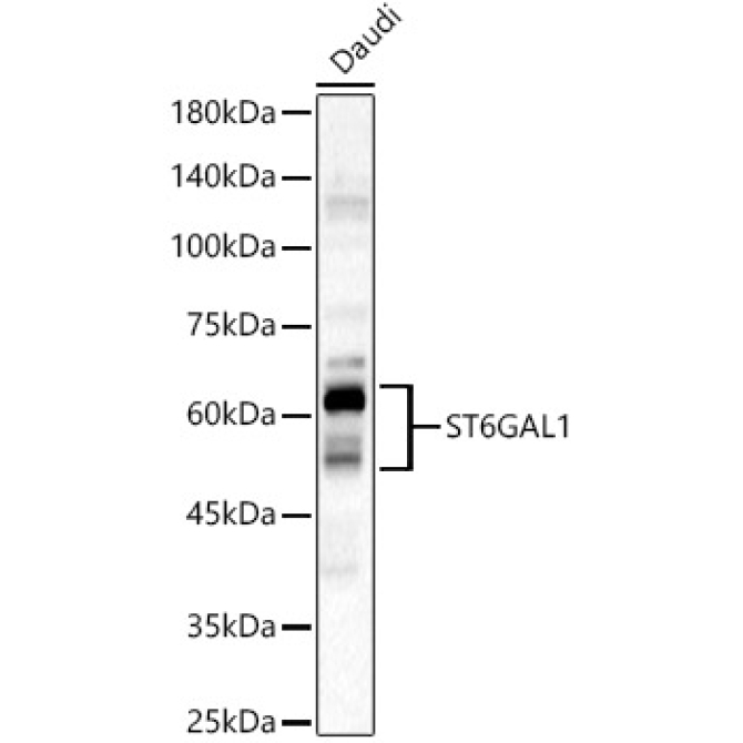 ST6GAL1 Rabbit Polyclonal Antibody