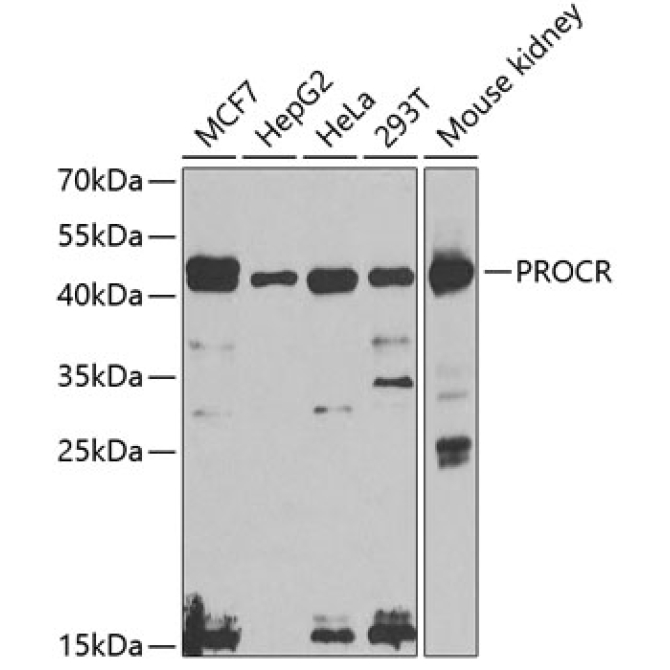PROCR Rabbit Polyclonal Antibody