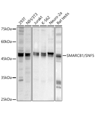SMARCB1/SNF5 Rabbit Polyclonal Antibody
