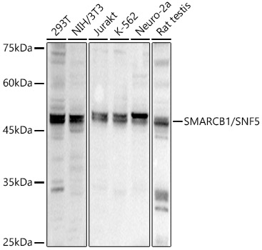 SMARCB1/SNF5 Rabbit Polyclonal Antibody