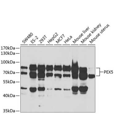 PEX5 Rabbit Polyclonal Antibody
