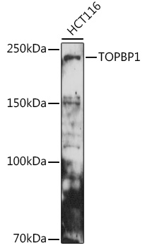 TOPBP1 Rabbit Polyclonal Antibody
