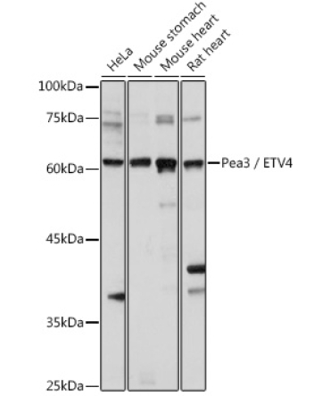 Pea3 / ETV4 Rabbit Polyclonal Antibody
