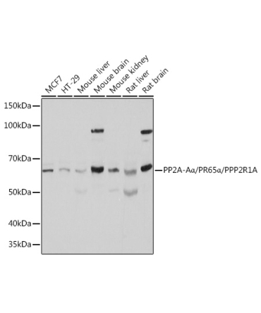 PP2A-AAlpha/PR65Alpha/PPP2R1A Rabbit Polyclonal Antibody