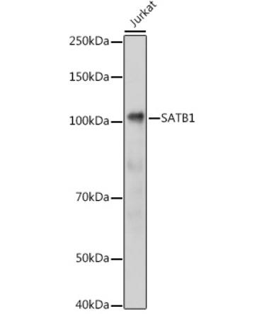 SATB1 Rabbit Polyclonal Antibody