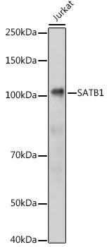 SATB1 Rabbit Polyclonal Antibody