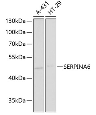 SERPINA6 Rabbit Polyclonal Antibody