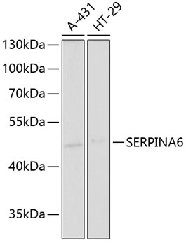SERPINA6 Rabbit Polyclonal Antibody