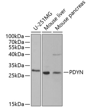 PDYN Rabbit Polyclonal Antibody
