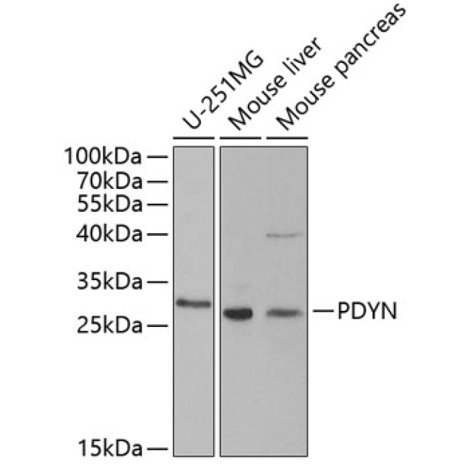 PDYN Rabbit Polyclonal Antibody