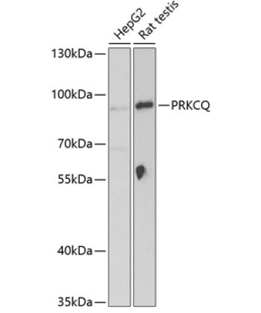 PRKCQ Rabbit Polyclonal Antibody