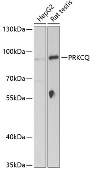 PRKCQ Rabbit Polyclonal Antibody
