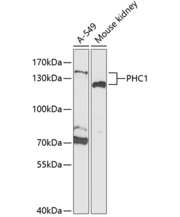 PHC1 Rabbit Polyclonal Antibody