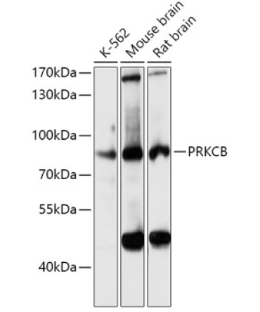 PKC-beta Rabbit Polyclonal Antibody