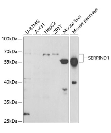 SERPIND1 Rabbit Polyclonal Antibody