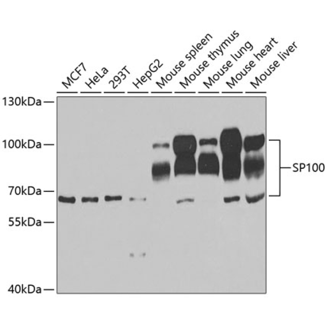 SP100 Rabbit Polyclonal Antibody