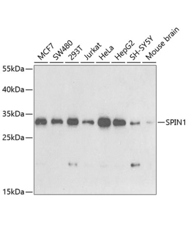 SPIN1 Rabbit Polyclonal Antibody