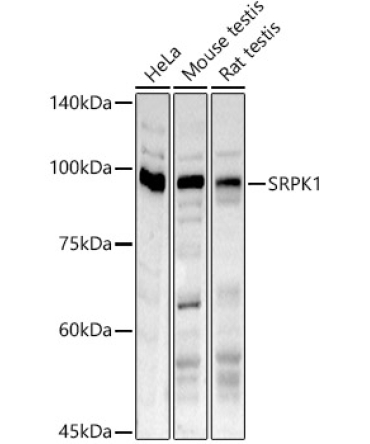SRPK1 Rabbit Polyclonal Antibody