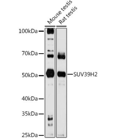 SUV39H2 Rabbit Polyclonal Antibody
