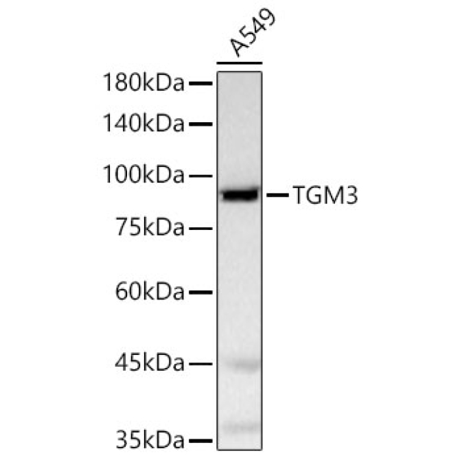 TGM3 Rabbit Polyclonal Antibody