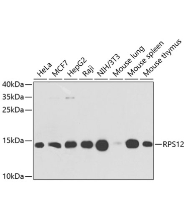 RPS12 Rabbit Polyclonal Antibody