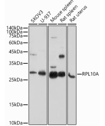 RPL10A Rabbit Polyclonal Antibody