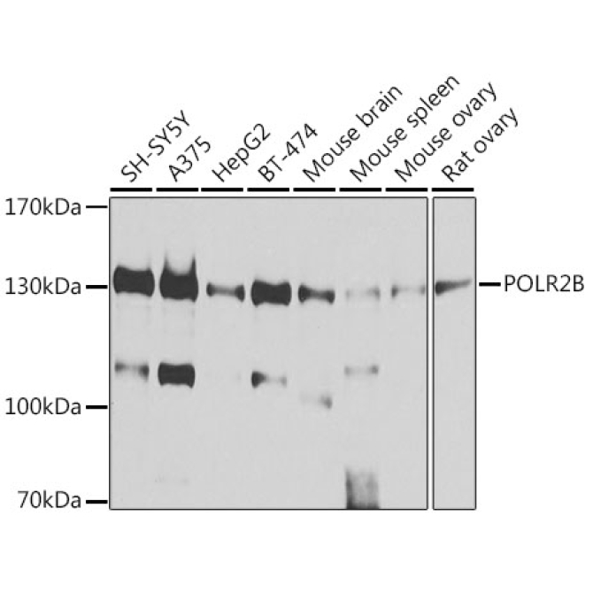 POLR2B Rabbit Polyclonal Antibody