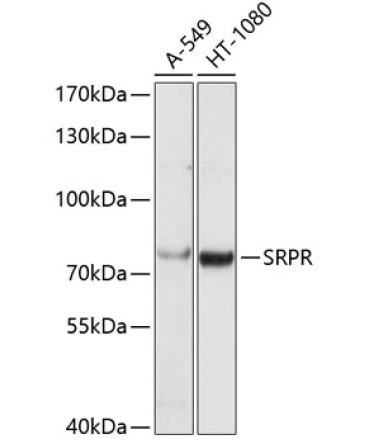 SRPR Rabbit Polyclonal Antibody