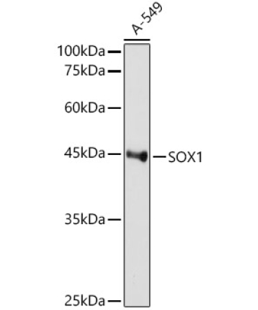 SOX1 Rabbit Monoclonal Antibody