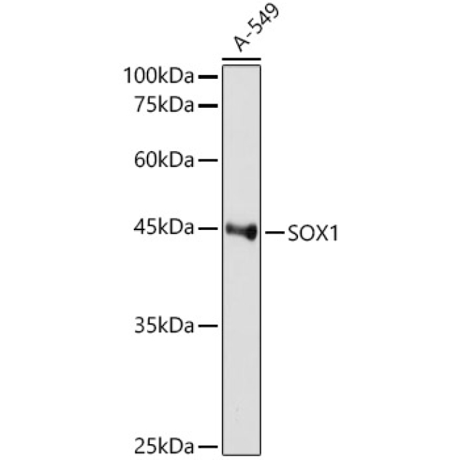 SOX1 Rabbit Monoclonal Antibody