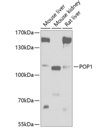 POP1 Rabbit Polyclonal Antibody
