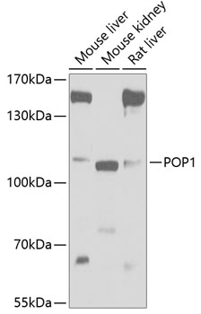 POP1 Rabbit Polyclonal Antibody