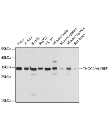 THOC4/ALYREF Rabbit Polyclonal Antibody