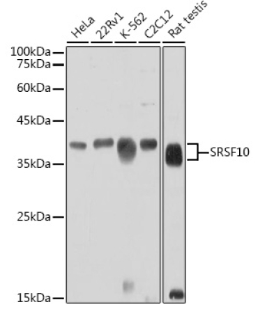SRSF10 Rabbit Polyclonal Antibody