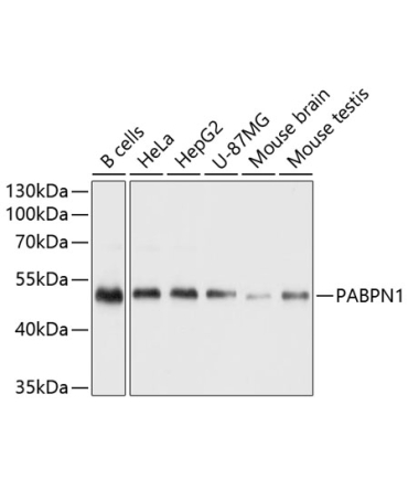 Polyclonal AntibodyPN1 Rabbit Polyclonal Antibody