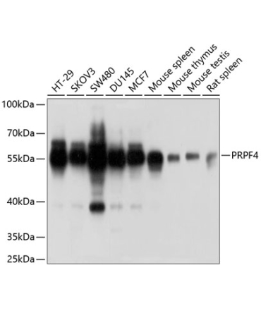 PRPF4 Rabbit Polyclonal Antibody